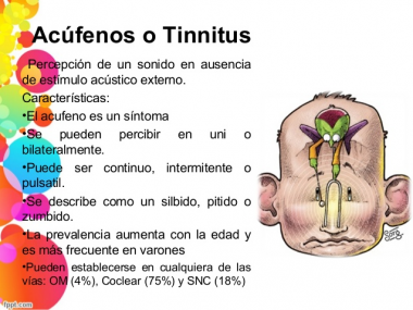 Nuestro cerebro influye en la percepción del tinnitus