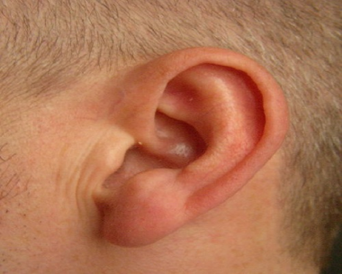 Pérdida auditiva: Síntomas y tratamiento