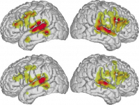 Así distingue tu cerebro entre conversaciones y ruido en una fiesta