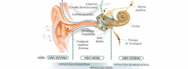 Hipoacusia, en busca de la solución